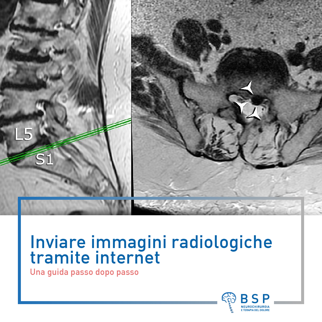 Inviare immagini radiologiche tramite internet